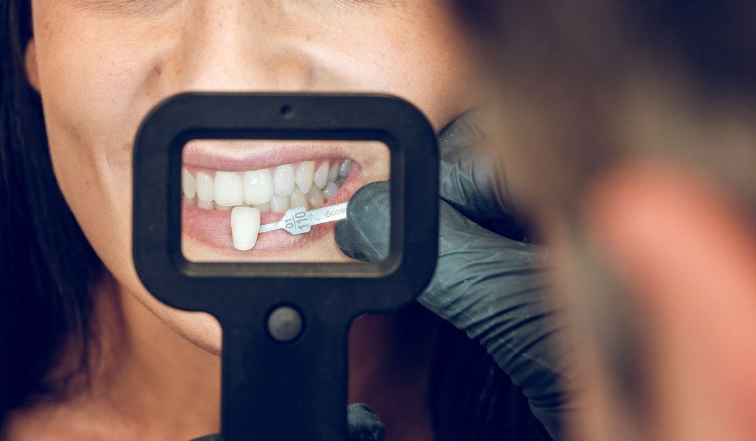 ¿Por qué el diseño de sonrisa debe hacerlo un odontólogo especialista?