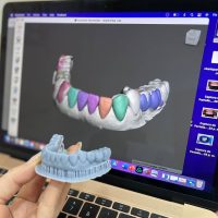 escaner digital escaner digital