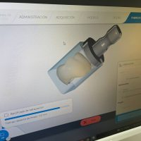 diseño de sonrisa diseño de sonrisa