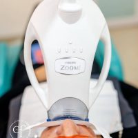 blanqueamiento-dental- blanqueamiento-dental-