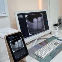 clinica dental providencia clinica dental providencia