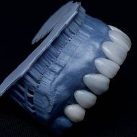 clinica dental providencia