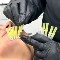 Lipopapada Lipopapada